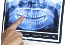 Рентгеновский снимок зуба