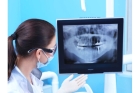 Рентген корней зубов
