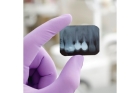 Прицельный рентгенографический снимок зуба 