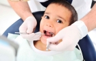 Лечение пульпита молочного зуба в 2-3 посещения (с учетом стеклоиономерной пломбы VITREMER)