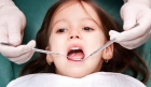Удаление нерва в молочном зубе