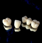 Коронка на зуб металлокерамика