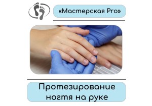 Протезирование ногтя на руке